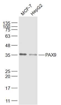 PAX9 Rabbit Polyclonal Antibody