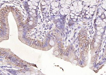 CDH17／LI Cadherin Rabbit Polyclonal Antibody