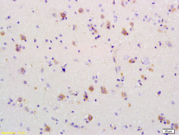 PDCD4 Rabbit Polyclonal Antibody