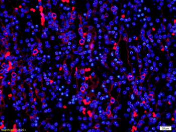 PDCD4 Rabbit Polyclonal Antibody