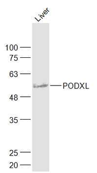 PODXL Rabbit Polyclonal Antibody