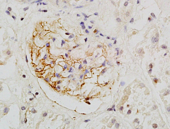 PODXL Rabbit Polyclonal Antibody