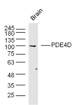 PDE4D Rabbit Polyclonal Antibody
