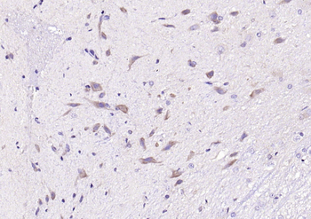 PDK4 Rabbit Polyclonal Antibody