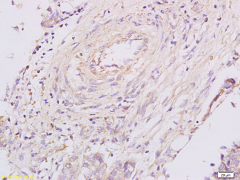 Granulin Rabbit Polyclonal Antibody