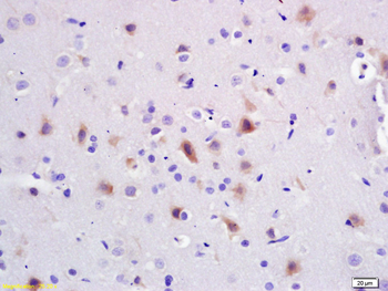 PIK3R1 Rabbit Polyclonal Antibody