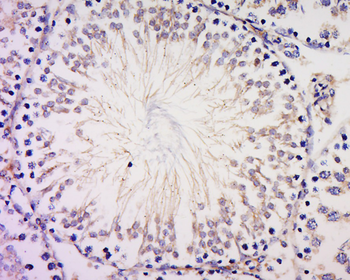 PIBF Rabbit Polyclonal Antibody