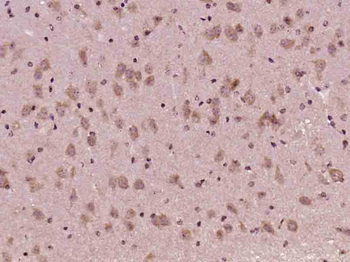 AKT1 Mouse Polyclonal Antibody