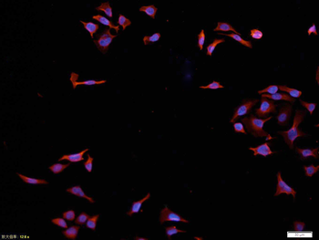 AKT1 Mouse Polyclonal Antibody