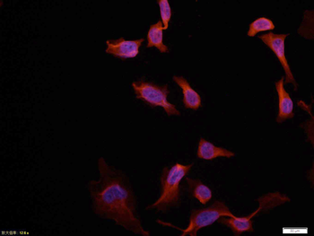AKT1 Mouse Polyclonal Antibody