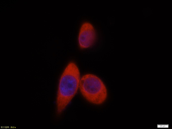AKT1 Mouse Polyclonal Antibody