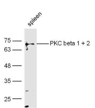 PRKCB Rabbit Polyclonal Antibody