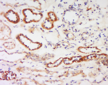 PRKCB Rabbit Polyclonal Antibody