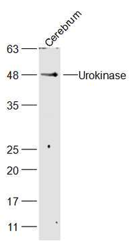 Urokinase Rabbit Polyclonal Antibody