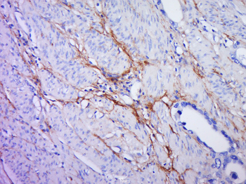 PLGF Rabbit Polyclonal Antibody