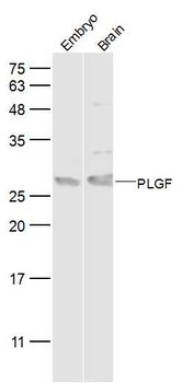 PLGF Rabbit Polyclonal Antibody