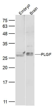 PLGF Rabbit Polyclonal Antibody