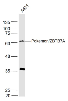 Pokemon/ZBTB7A Rabbit Polyclonal Antibody