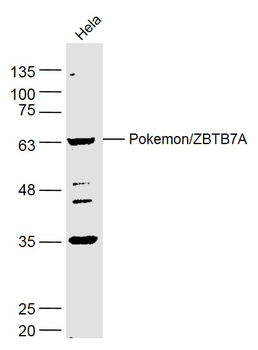 Pokemon/ZBTB7A Rabbit Polyclonal Antibody