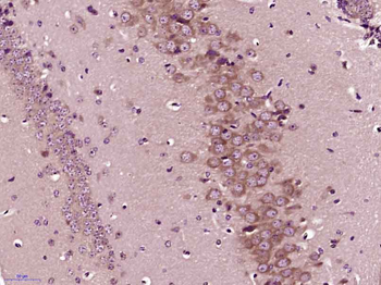 PP2A alpha + beta Rabbit Polyclonal Antibody