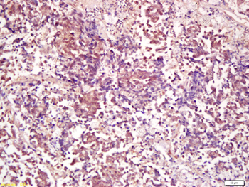 PP2A alpha + beta Rabbit Polyclonal Antibody
