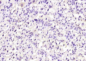 PPAR gamma Rabbit Polyclonal Antibody