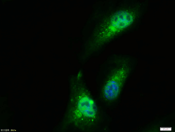 PPAR gamma Rabbit Polyclonal Antibody