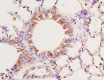 PPAR gamma Rabbit Polyclonal Antibody