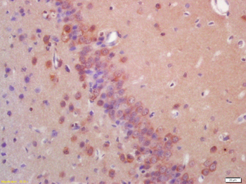 EIF2AK2 (PKR) Rabbit Polyclonal Antibody
