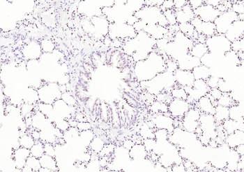 AKT2 Rabbit Polyclonal Antibody