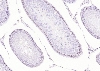 AKT2 Rabbit Polyclonal Antibody