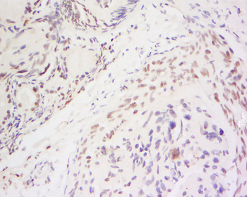 AKT2 Rabbit Polyclonal Antibody