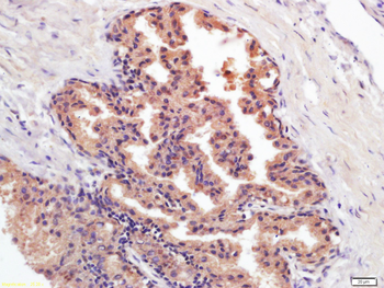 PSA Mouse Monoclonal Antibody