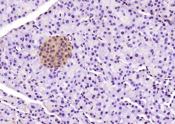 PSMD9 Rabbit Polyclonal Antibody