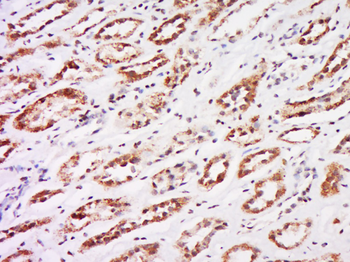 PTHLH Rabbit Polyclonal Antibody