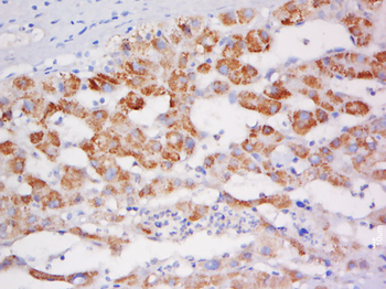 PTHLH Rabbit Polyclonal Antibody