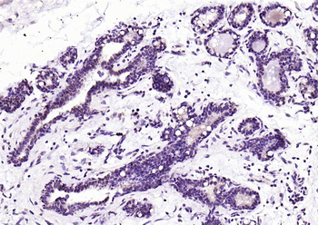 RARB Rabbit Polyclonal Antibody