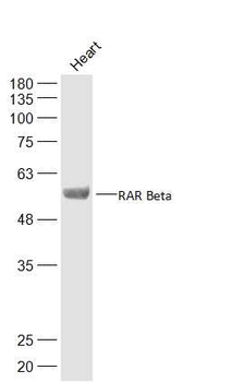 RARB Rabbit Polyclonal Antibody