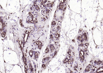 Resistin Rabbit Polyclonal Antibody