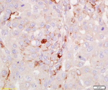 RGS2 Rabbit Polyclonal Antibody