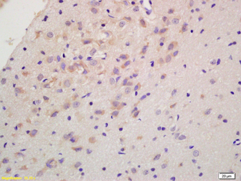 RGS2 Rabbit Polyclonal Antibody