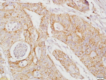 RhoA Rabbit Polyclonal Antibody