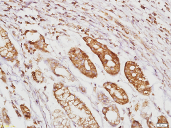 RhoA Rabbit Polyclonal Antibody