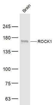 ROCK1 Rabbit Polyclonal Antibody