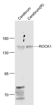 ROCK1 Rabbit Polyclonal Antibody