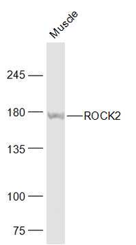 ROCK2 Rabbit Polyclonal Antibody