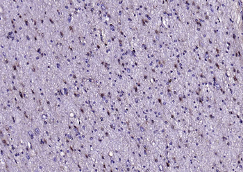 S100B Rabbit Polyclonal Antibody