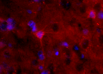S100B Rabbit Polyclonal Antibody