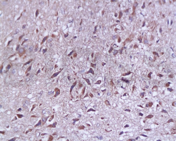 SYAP1 Rabbit Polyclonal Antibody