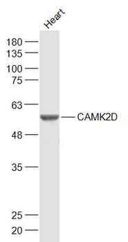 CaMKII delta Rabbit Polyclonal Antibody